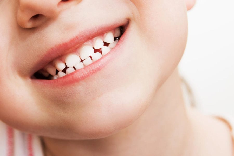 Are My Child's Baby Teeth Important? Dr. Allie Miller, DDS
