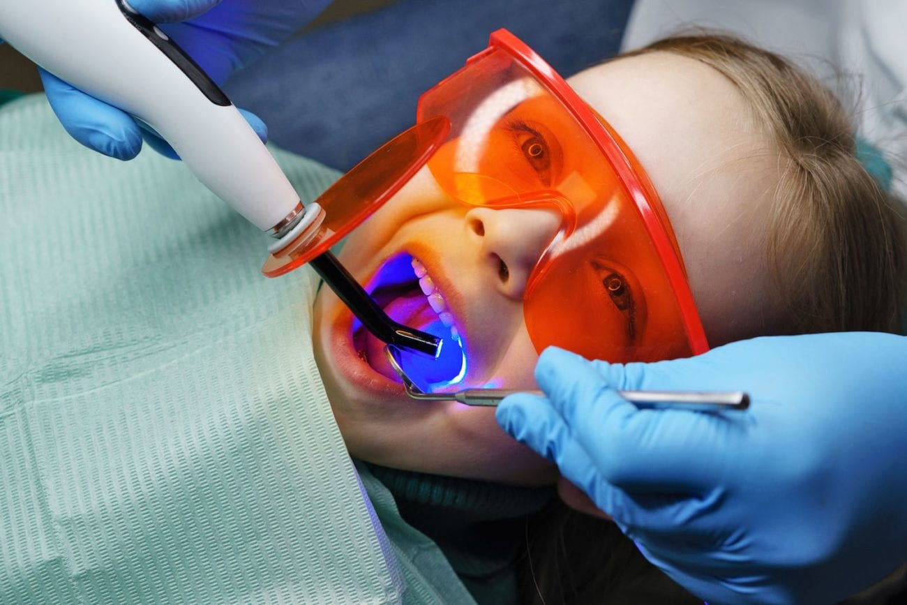 Pediatric Dental Fillings Winter Park, FL Dental Fillings Pediatric Dental Fillings Winter Park, FL Dental Fillings