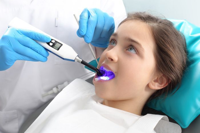 dental sealant procedure Winter Park Florida