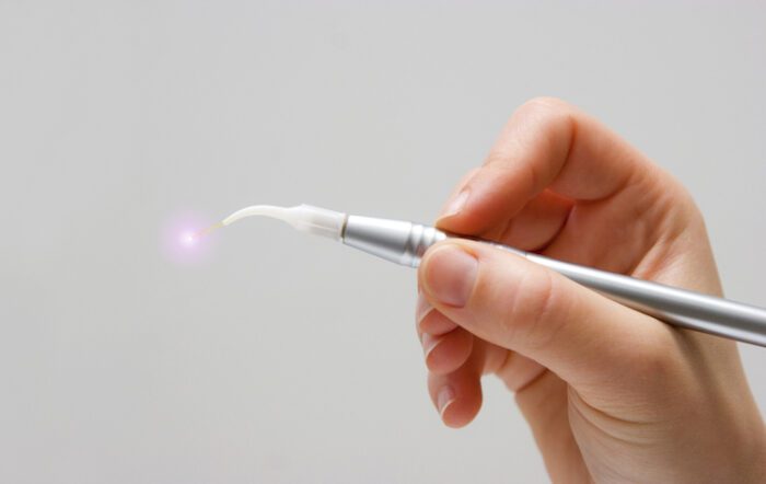 Laser dentistry offers a modern alternative to frenectomies that could cause pain, discomfort, or fear in younger patients.